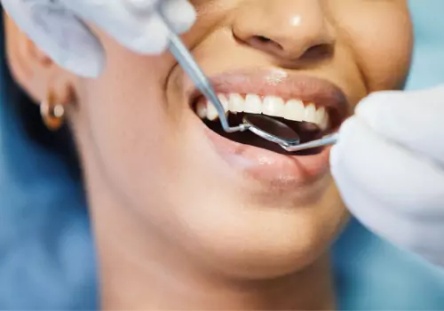 Dental Clinic East Peoria IL