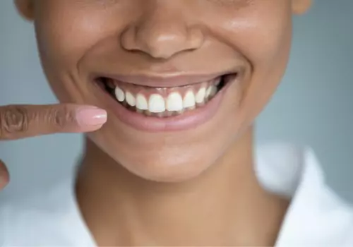 A woman pointing to her smile after work from a Cosmetic Dentist for Peoria IL