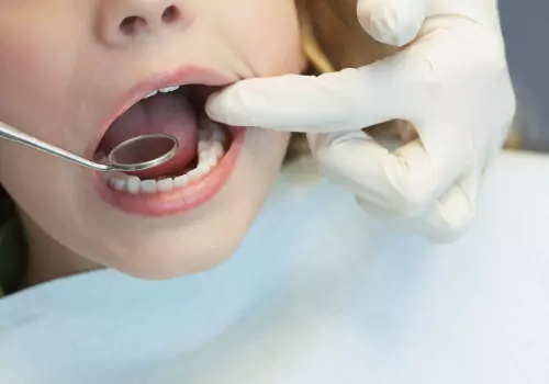 A little girl having her teeth checked for cavities, part of Family Dental Care in Pekin IL