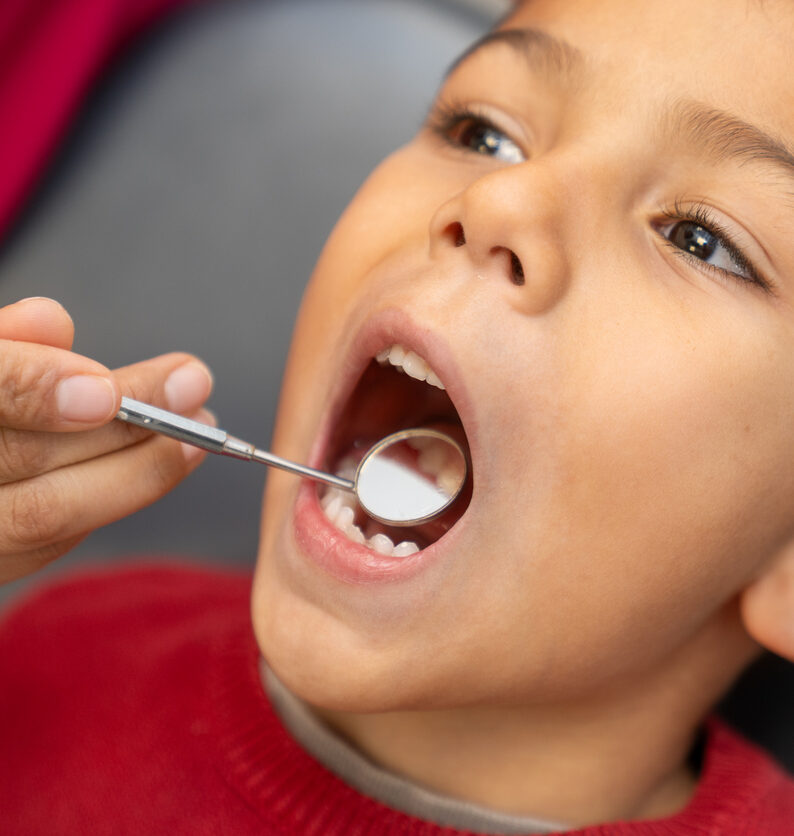A young boy gets his teeth checked after an appointment for dental emergencies from Total Dental Care